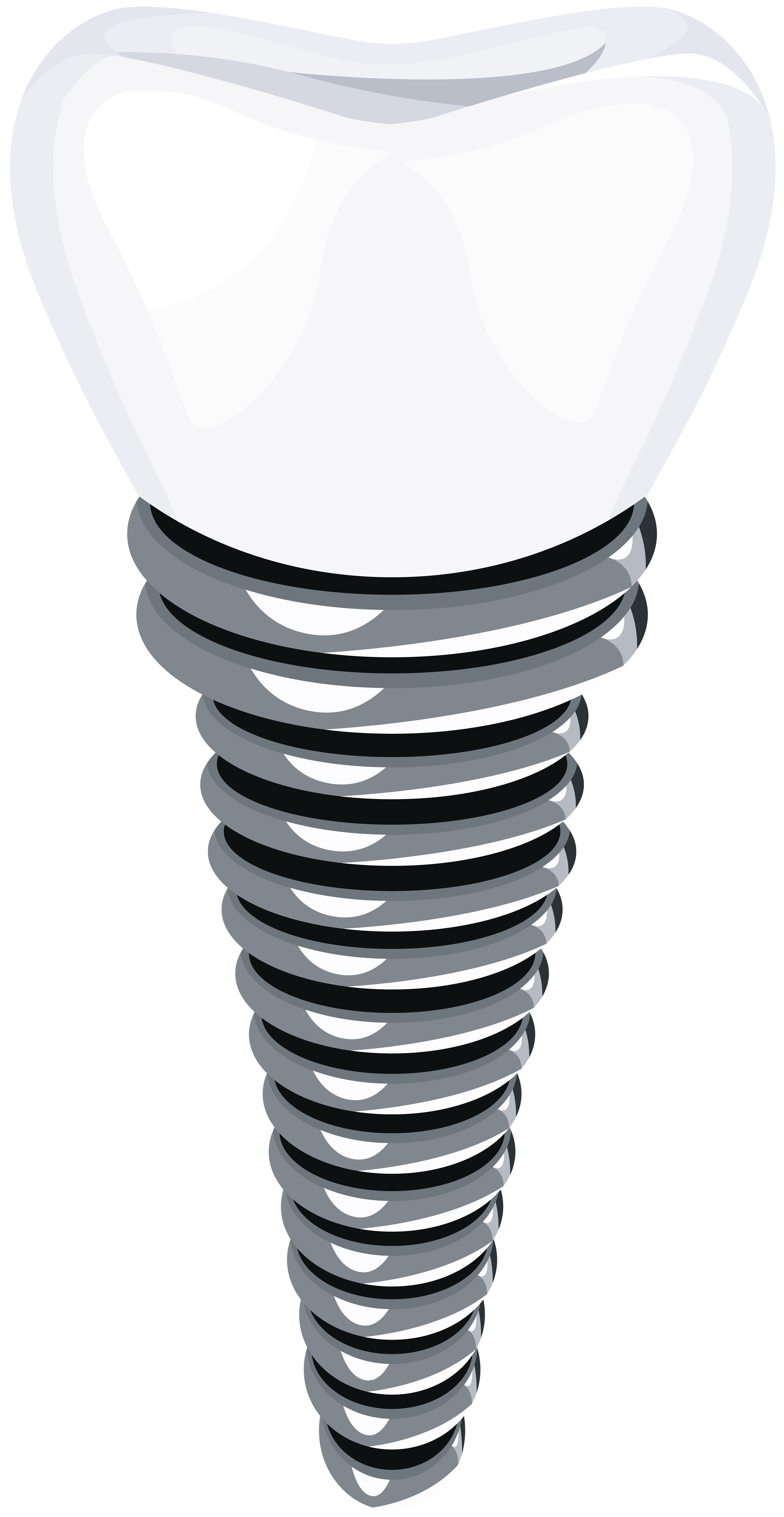 Dental Implant PNG Clip Art - Best WEB Clipart